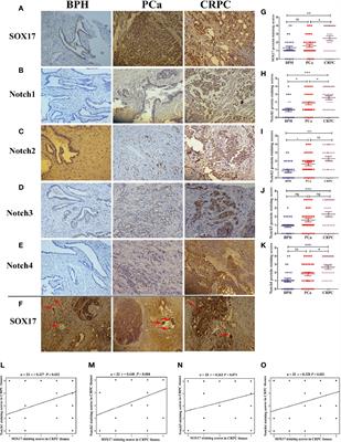 Systematic Evaluation for the Influences of the SOX17/Notch Receptor Family Members on Reversing Enzalutamide Resistance in Castration-Resistant Prostate Cancer Cells